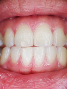 teeth-887338_1280