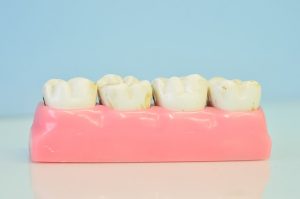 macromodelo-of-teeth-1437437_640