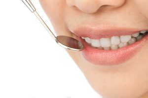 Healthy woman teeth and a dentist mouth mirror